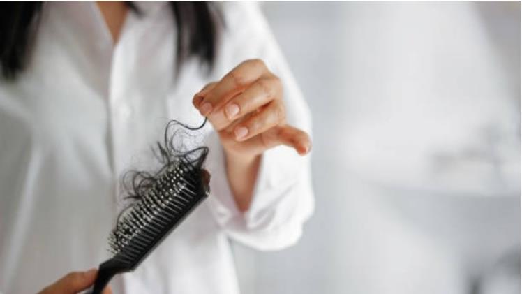 Transform Your Confidence with Advanced Hair Loss Solutions in Singapore